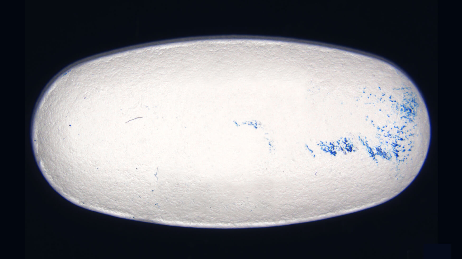 analyse de corps étrangers, identification de dépôt bleu sur pilule médicament, laboratoire cofrac